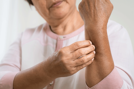 Woman scratching arm