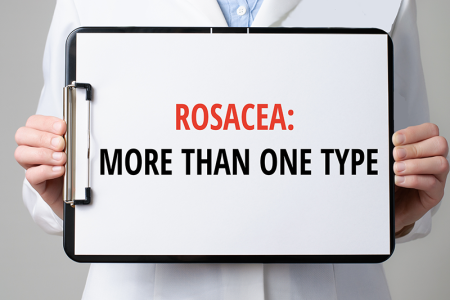 Article about multiple types of Rosacea