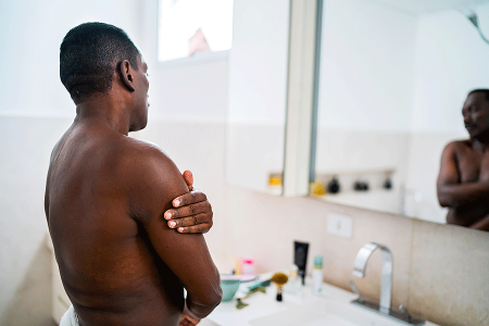Man with early-stage mycosis fungoides looking at his skin in his bathroom mirror.