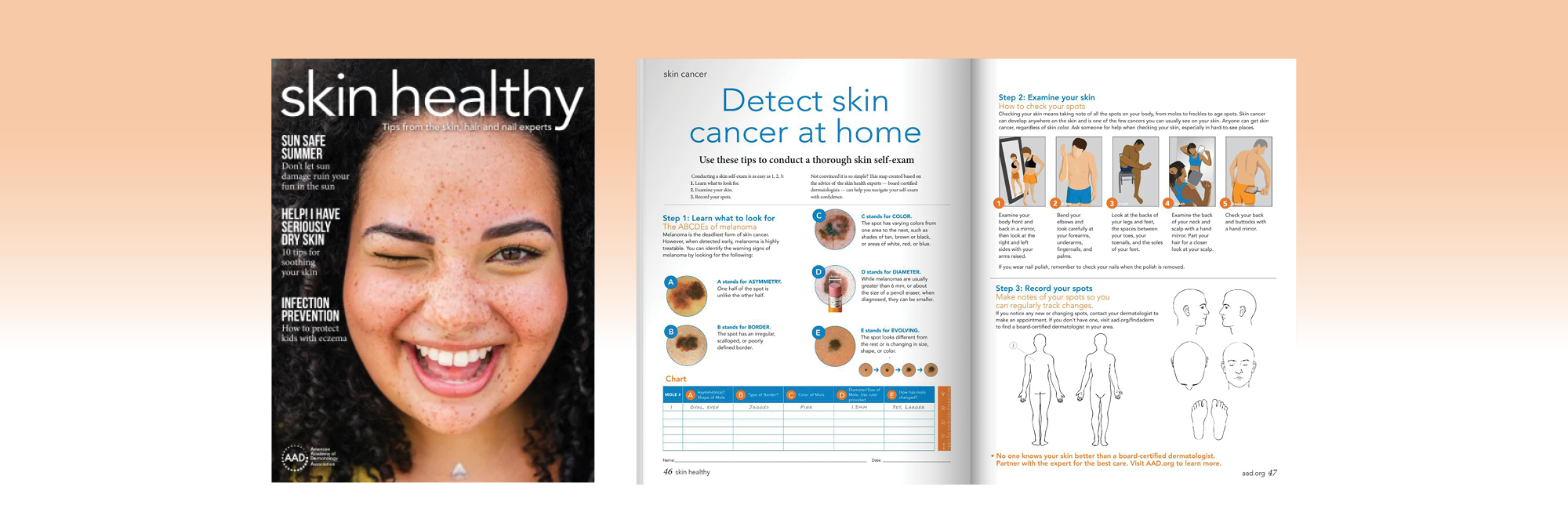 Impact Report 2023, Issue-3: New skin healthy issue distributed to members