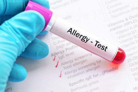 Allergy test
