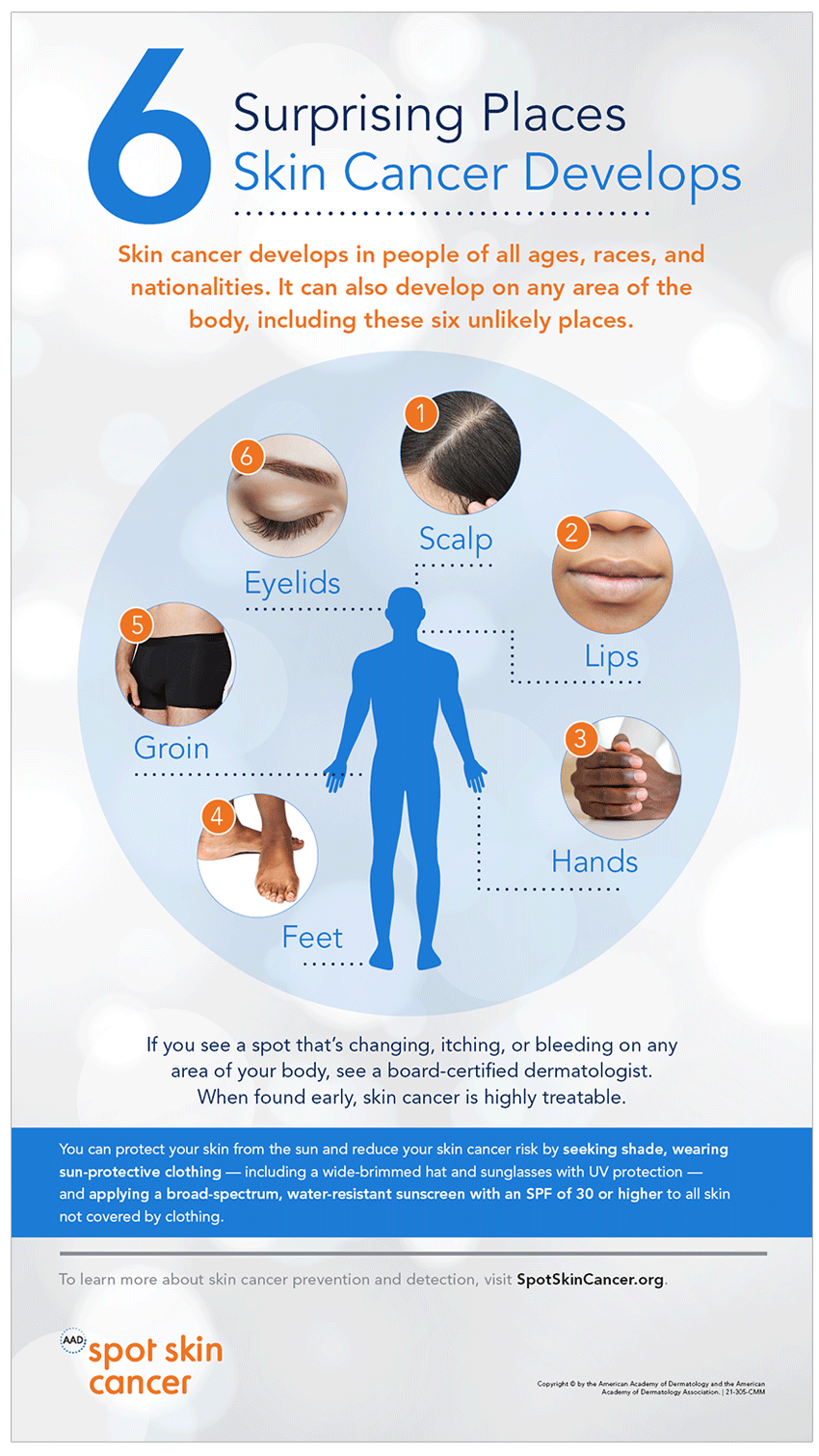 Skin Cancer Causes