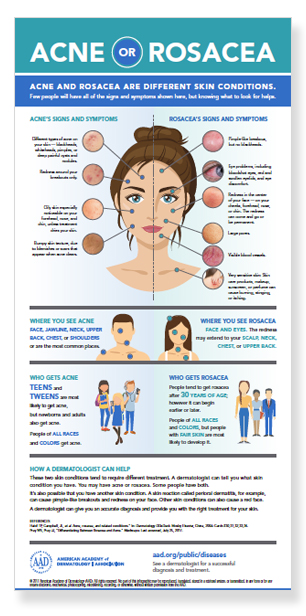 Chart on acne or rosacea