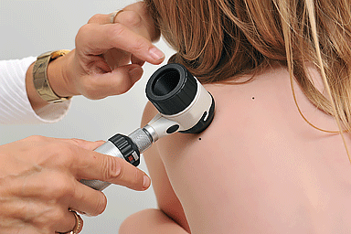 Dermatologist examining child's mole