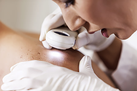 Dermatologist using a dermatoscope to get a close-up look at patient’s skin