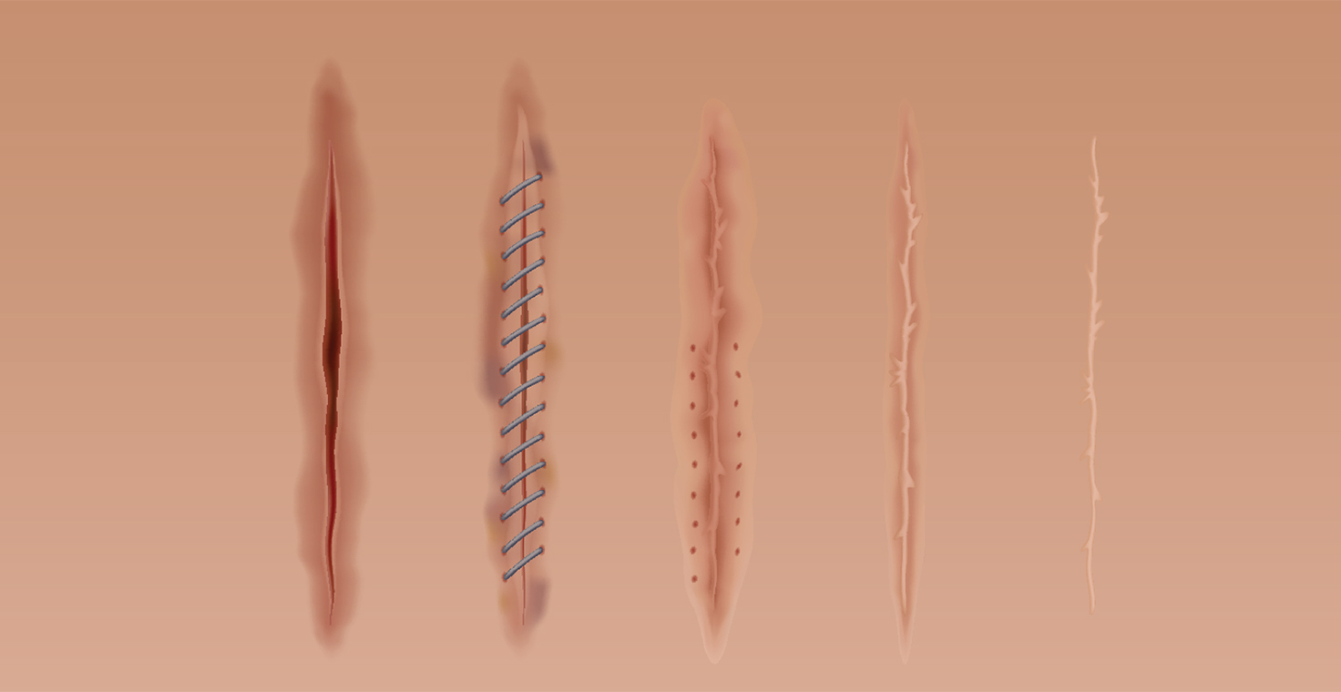 Banner for scar solutions