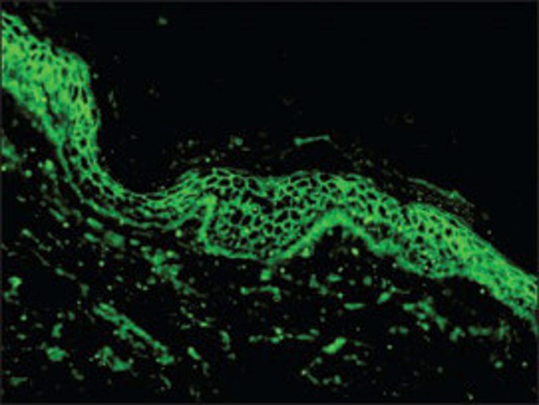 Image for DWII on honey as dermatopathology preservative