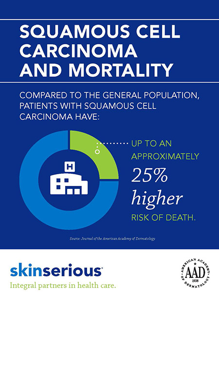 Squamus cell carcinoma infographic image