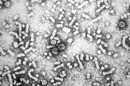 Hepatitis B virus (HBV)