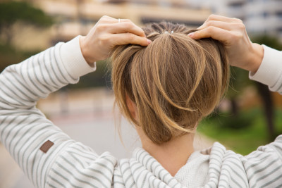 Hair loss: Signs and symptoms