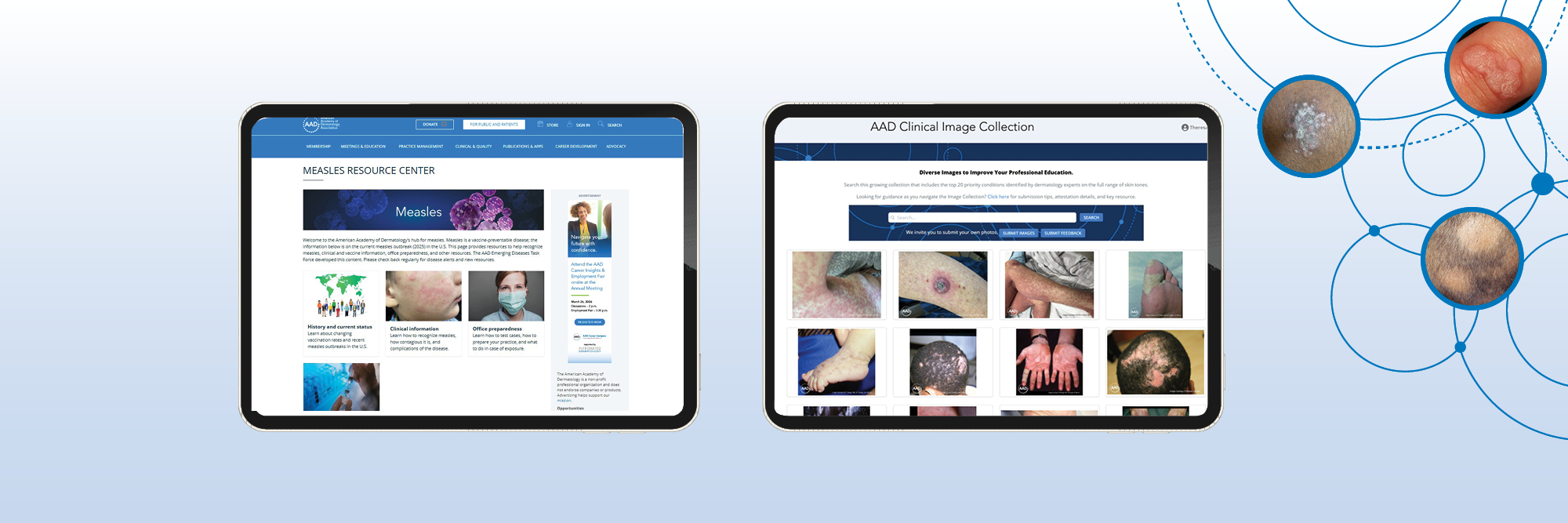 Screen capture from the AAD Clinical Image Collection.