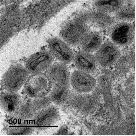 Image of mpox virus