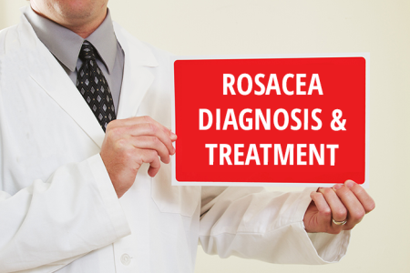Rosacea: Diagnosis and treatment