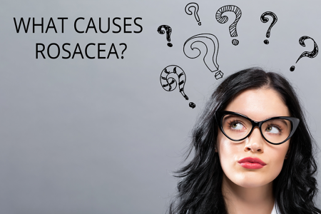 Article about what causes Rosacea