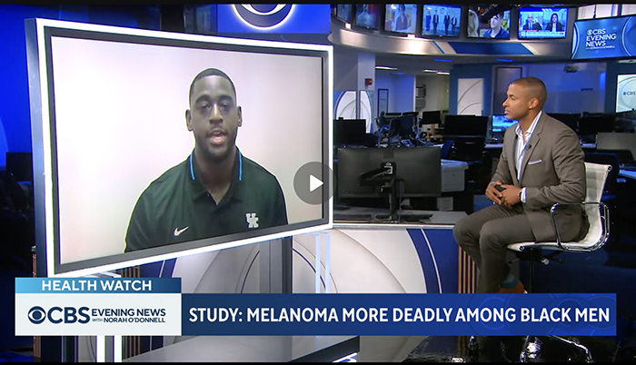 Melanoma in men CBS news video screenshot
