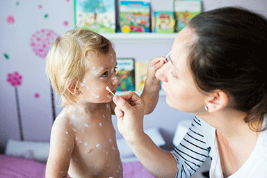 Little girl at home sick with chickenpox, white antiseptic cream applied by her mother to the rash