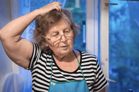 Woman scratching itchy scalp