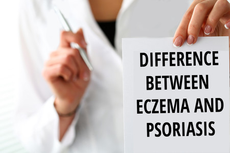 Doctor photo with the text difference between eczema and psoriasis