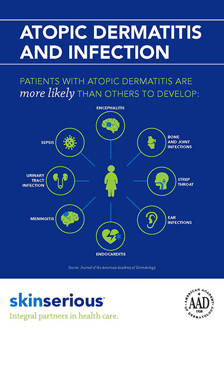 Infographic about atopic dermatitis and autoimmune disease