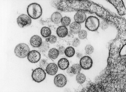 Hantavirus CDC image card