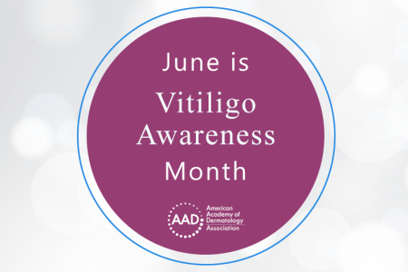 June is Vitiligo Awareness Month - AAD circle icon image