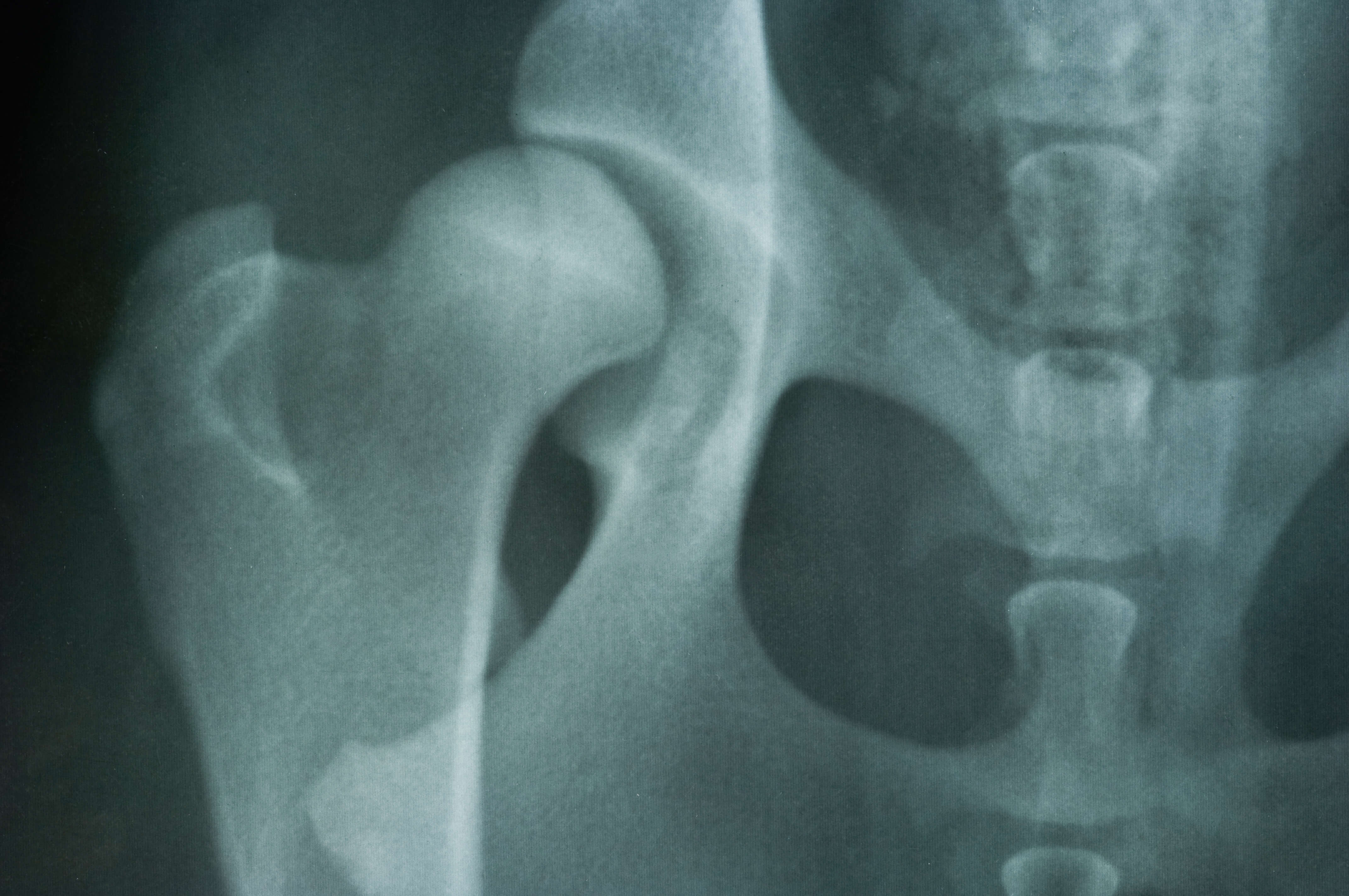 Hip Dysplasia in Dogs: Everything You Need to Know 1 dog hip x-ray