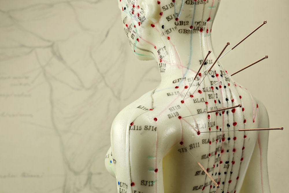 Acupuncture for Dogs: The Incredible Health Benefits 2 how does acupuncture work