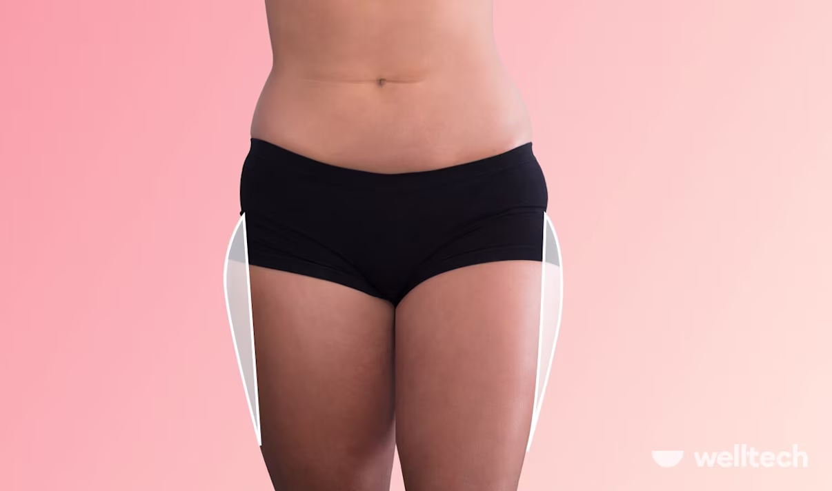 How to Get Rid of Saddlebags: Achieve Sleeker Silhouette with These Tips