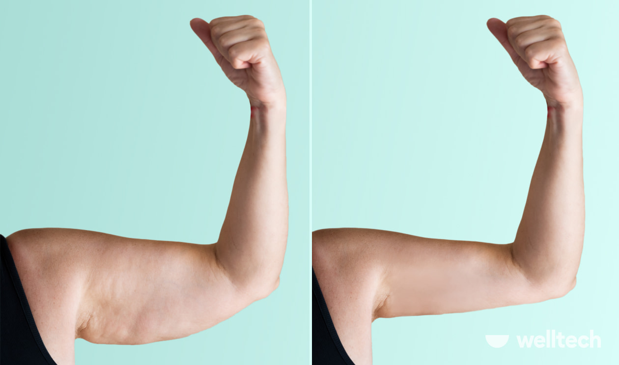 7 Exercises For Flabby Arms Over 60