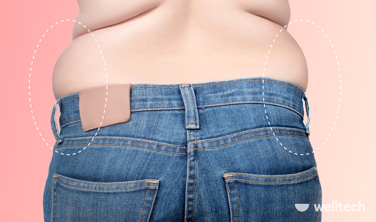 What Is Muffin Top, And How To Get Rid Of It?