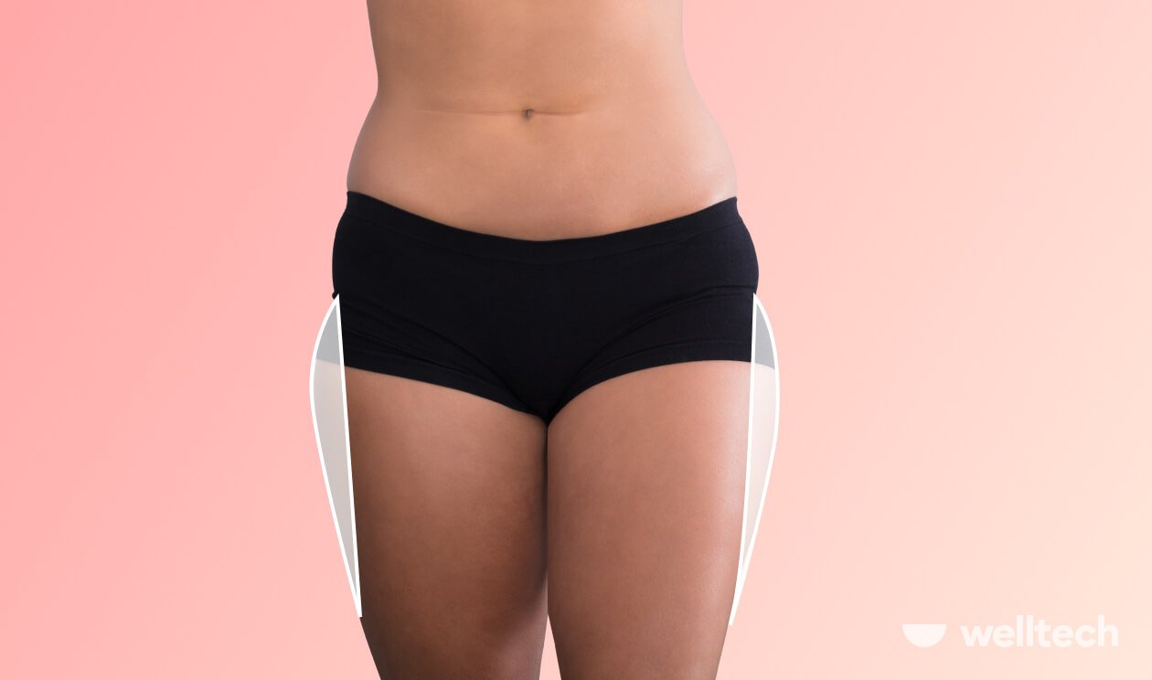 How to Get Rid of Saddlebags: Achieve Sleeker Silhouette with These Tips