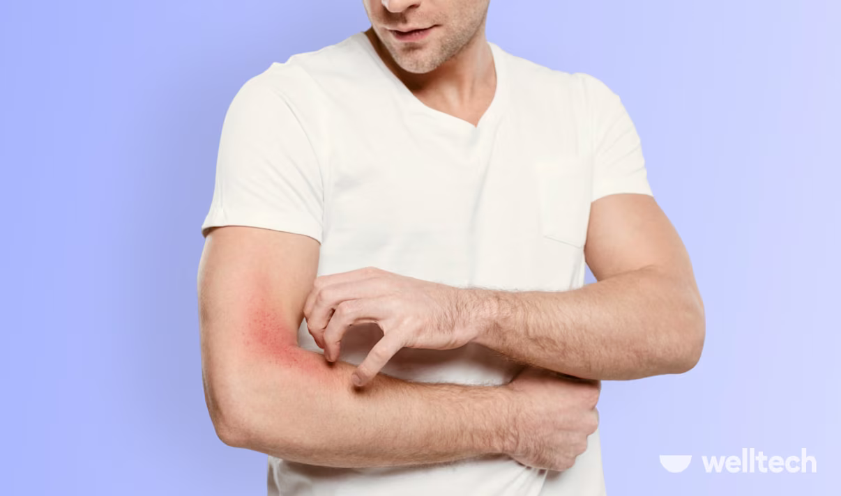 Why Does Pre-Workout Make You Itch? (& How to Stop It) 