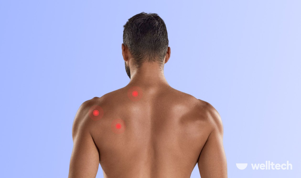 What Does A Muscle Knot Feel Like And What to Do If You Have One?