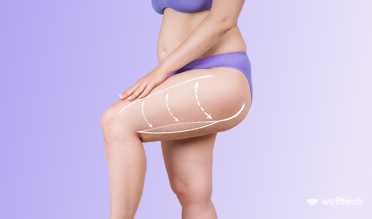 How To Lose Weight In Thighs And Butt [The Only Guide You Need]