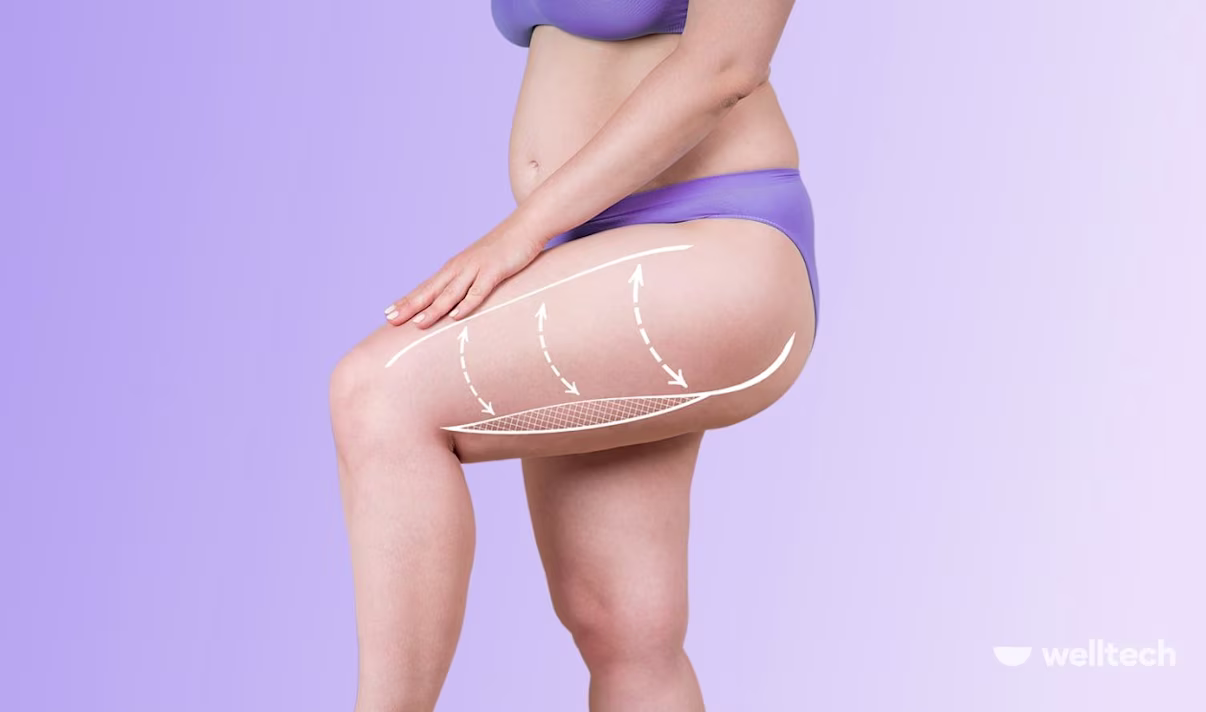 How To Lose Weight In Thighs And Butt [The Only Guide You Need]