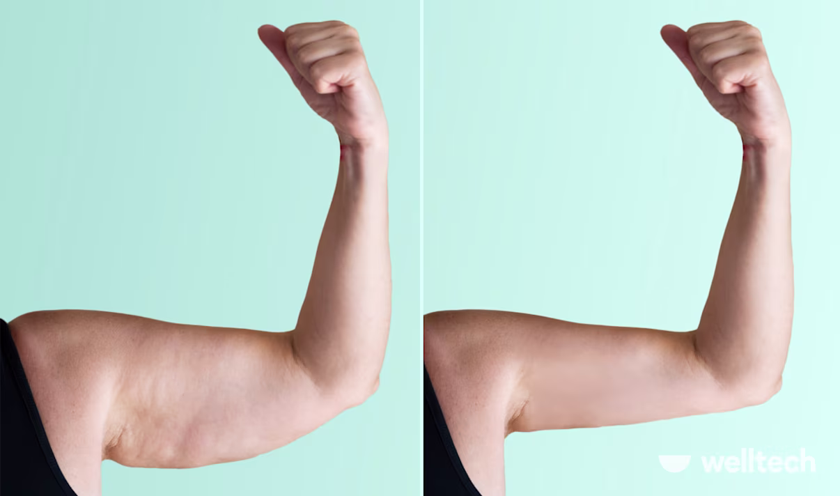 7 Exercises For Flabby Arms Over 60