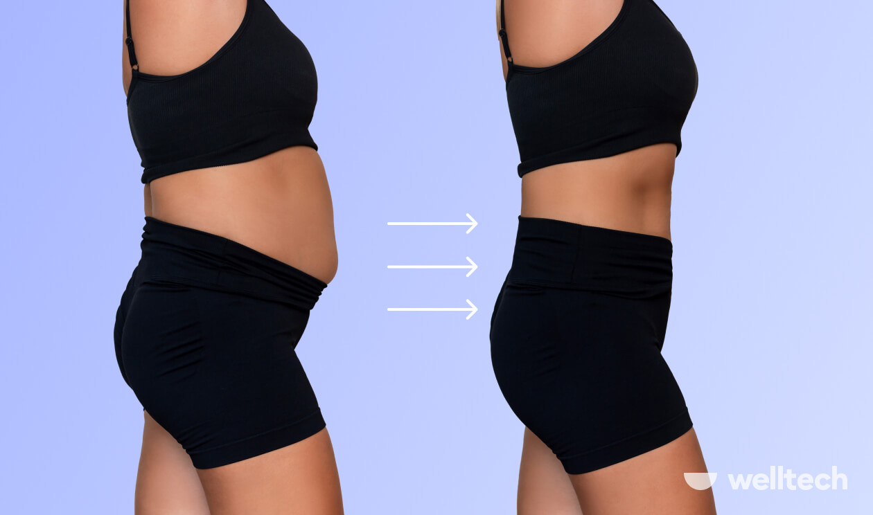 Belly Fat Won’t Budge? Here’s What To Do