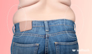 What Is Muffin Top And How To Get Rid Of It Welltech
