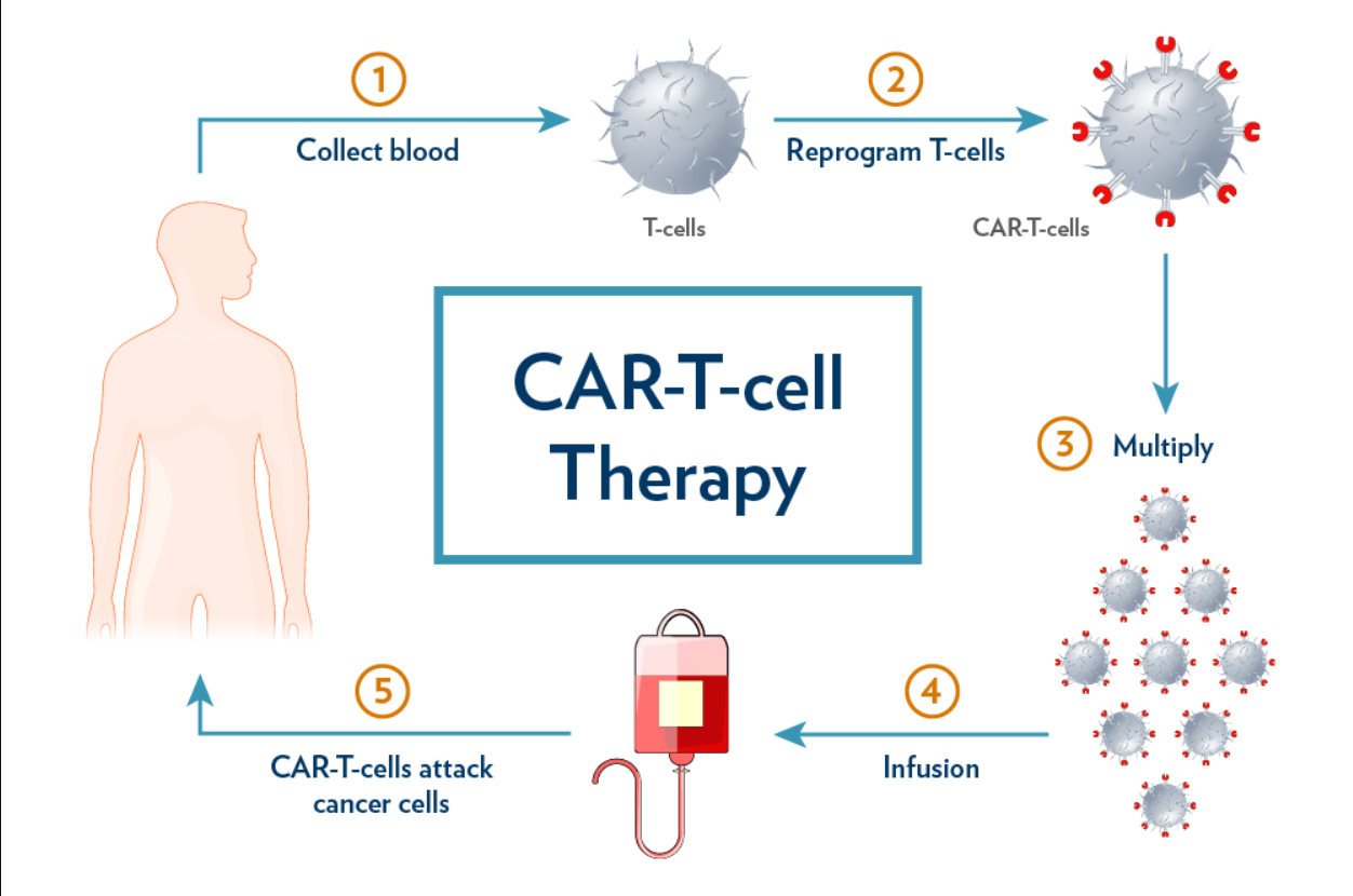 Chimeric Antigen Receptor (CAR) T-Cell Therapy