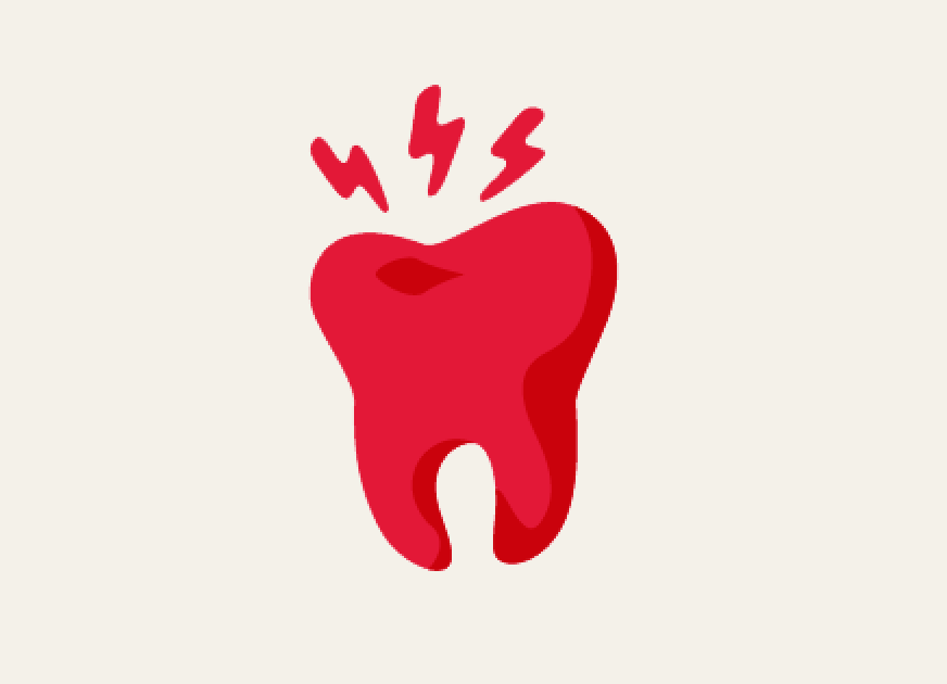 Tooth illustration