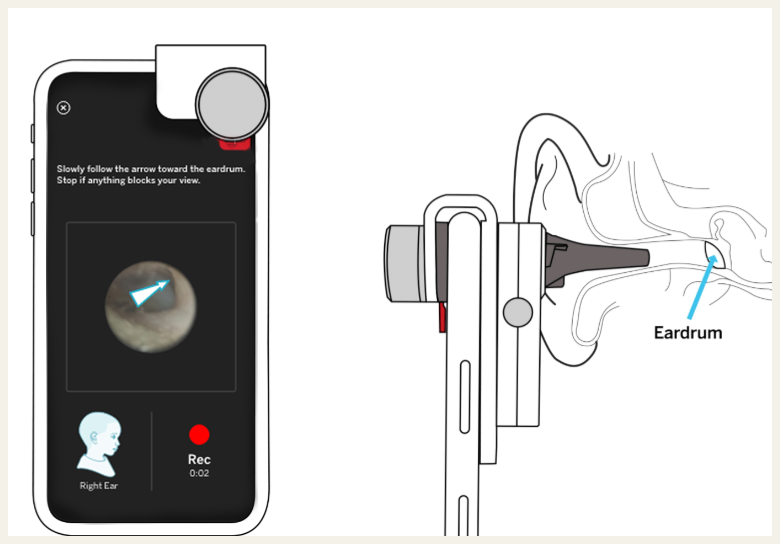 SmartCheck Step-by-step: Take a Recording