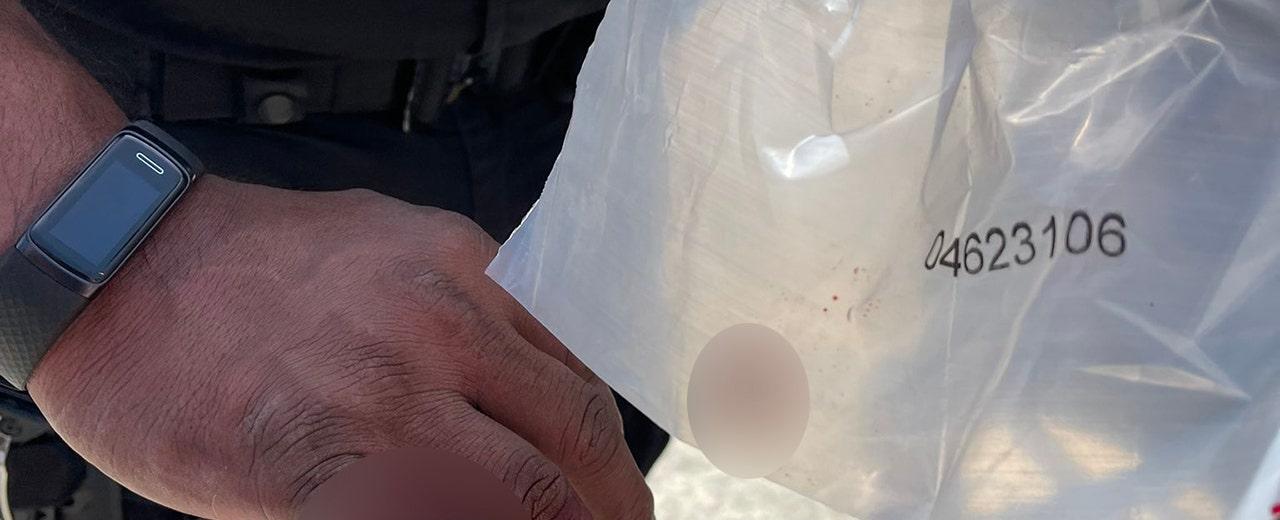 Los Angeles police officer loses part of finger bitten off by homeless man, LAPD says