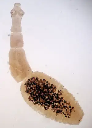 Echinococcus granulosus Ganímedes / Wikipaedia / CC BY-SA 4.0  