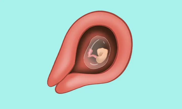 Embryolage in der 5. SSW