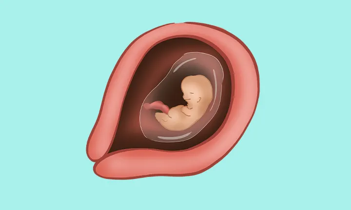 Embryolage in der 8. SSW