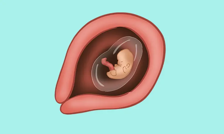 Embryolage in der 7. SSW