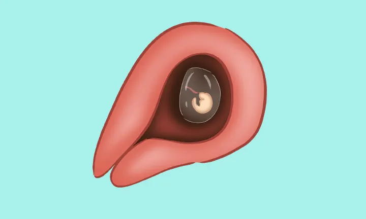 Embryo in der 4. Schwangerschaftswoche