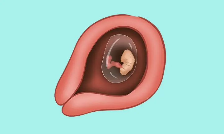 Embryolage in der 6. SSW