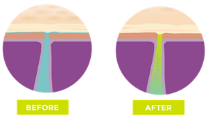 why_do_my_armpits_sweat_and_how_can_i_stop_it-2_IMG