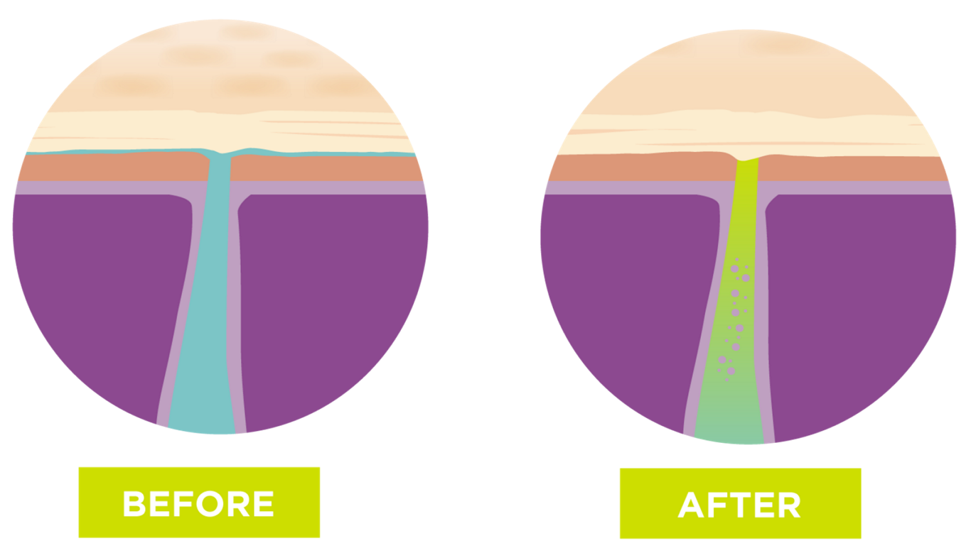 what_is_antiperspirant_how_it_works_safety_and_tips-5_IMG